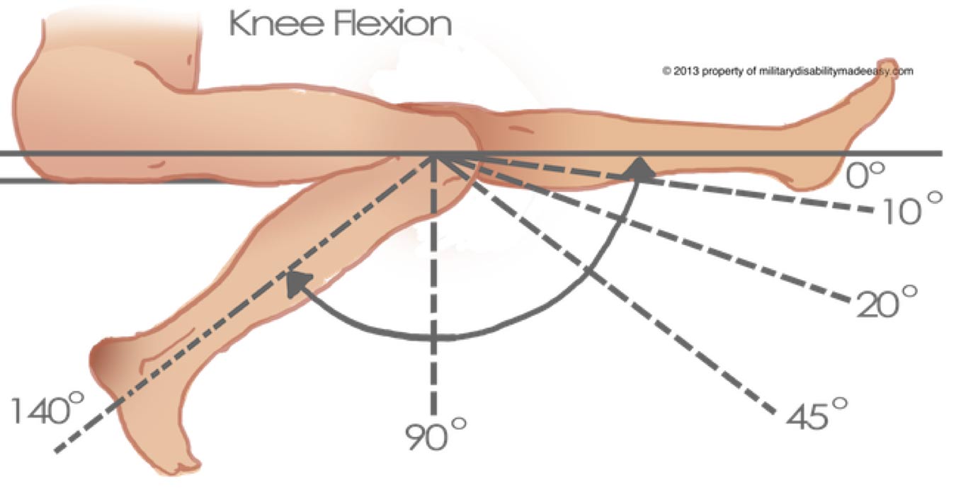 Liposuction Shown To Improve Knee Function