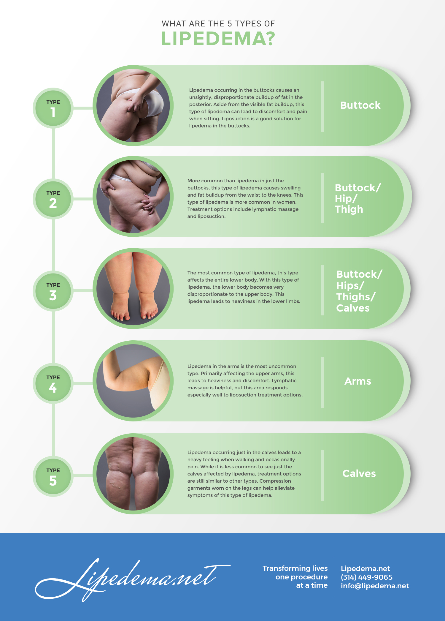 what is Lipedema fat