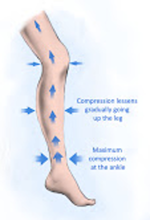 compression tights for lipedema Trelleborg TR