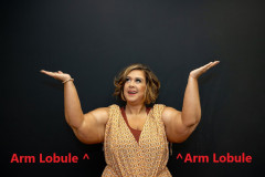 Arm-Lobules-Bilateral-labeled