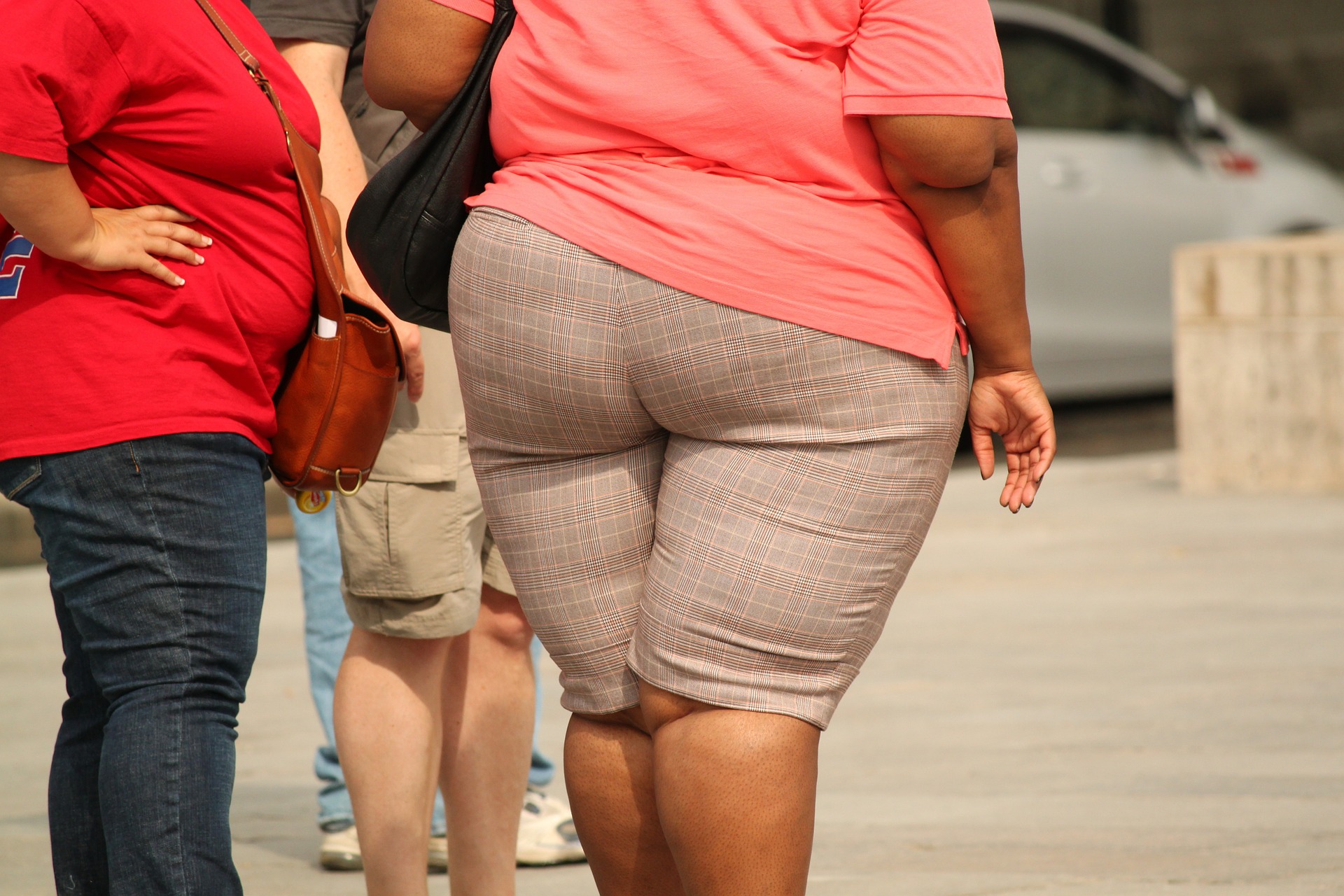 New Treatment for Dercum's Disease | Lipedema.net