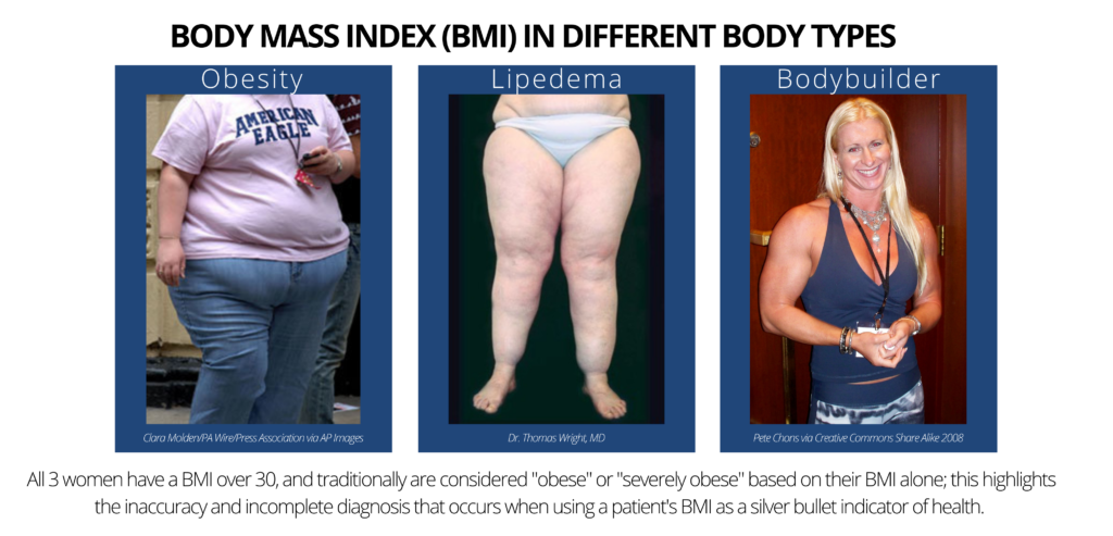 Infographic displaying BMI Body Types