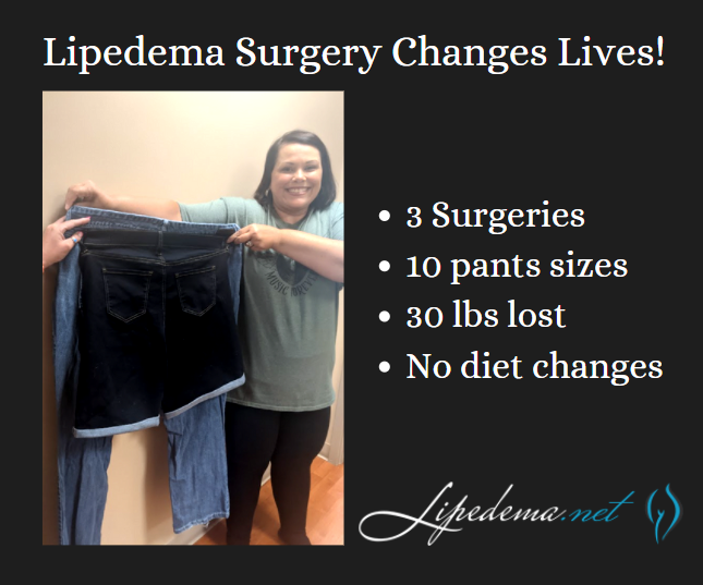 lipedema surgery