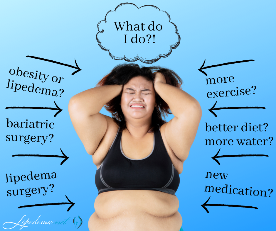 lipedema treatment