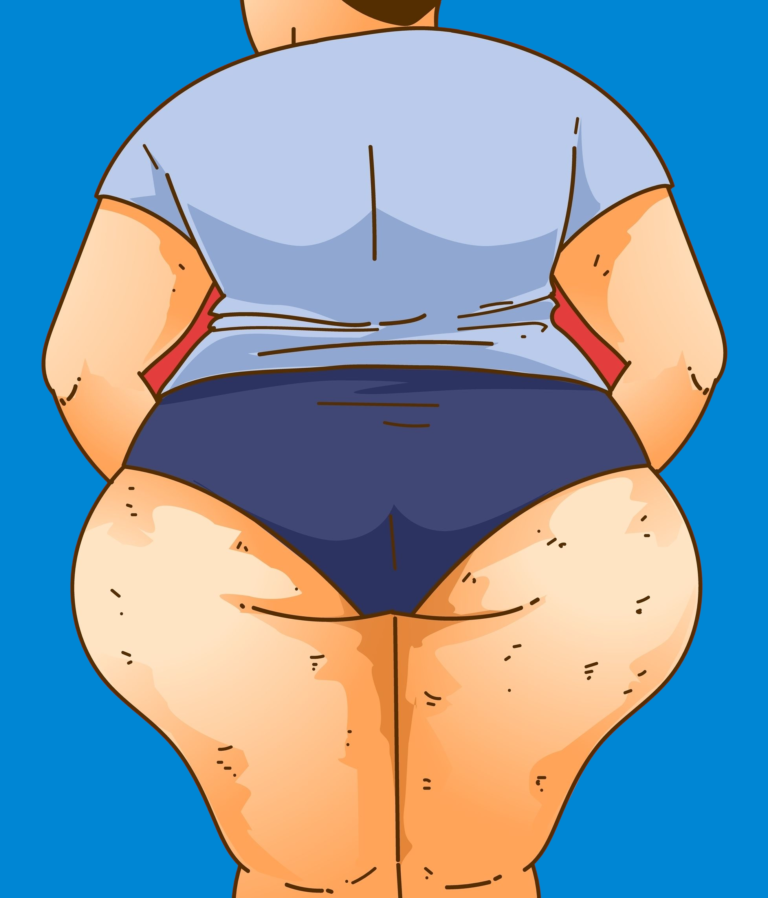 Find Out More About Lymphatics and Lipedema Surgery | Lipedema.net