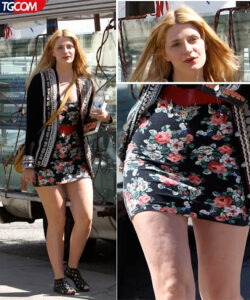 » Celebrities with Lipedema: Stories of Struggle, Acceptance, and