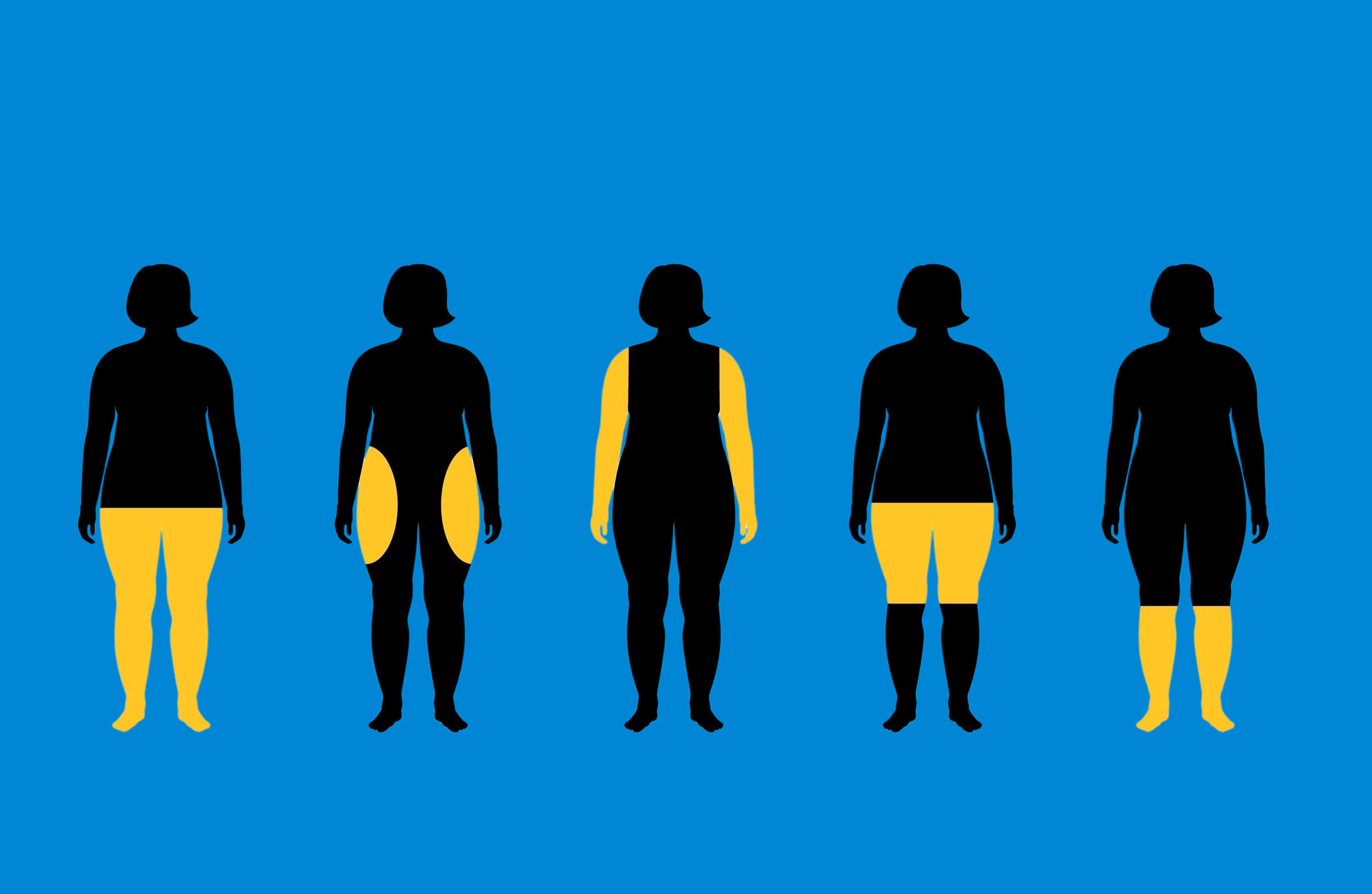 Navigating United Healthcare Lipedema Insurance Coverage Lipedema